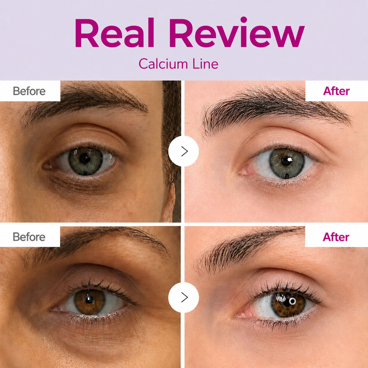 LAST DAY 50% OFF!! Korean Calcium Dark Spot Eye Cream