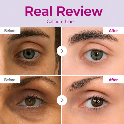 LAST DAY 50% OFF!! Korean Calcium Dark Spot Eye Cream